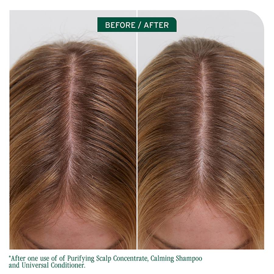 Matrix Biolage Scalp Sync Purifying Concentrate