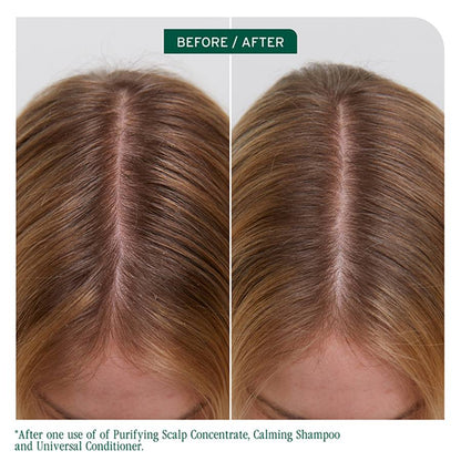 Matrix Biolage Scalp Sync Purifying Concentrate